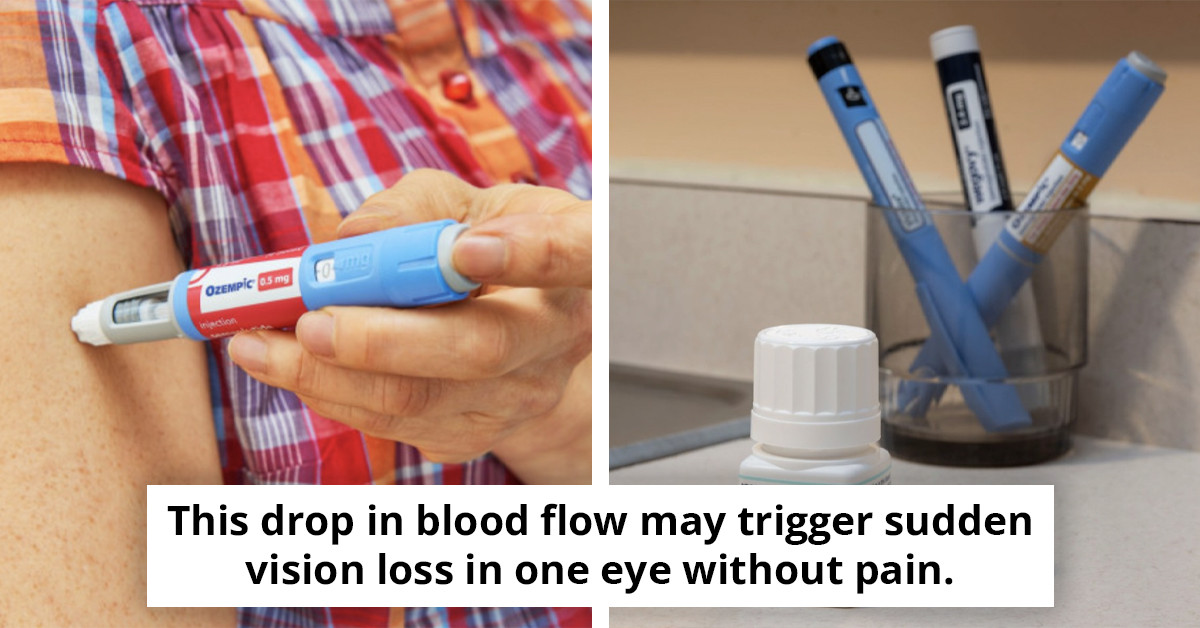 Health authorities caution that weight-loss injections may lead to unexpected vision loss following the introduction of updated safety warnings.