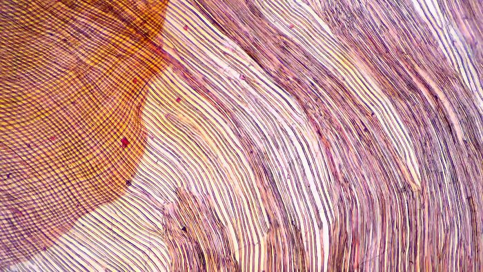 "Winged Seed Under Microscope"