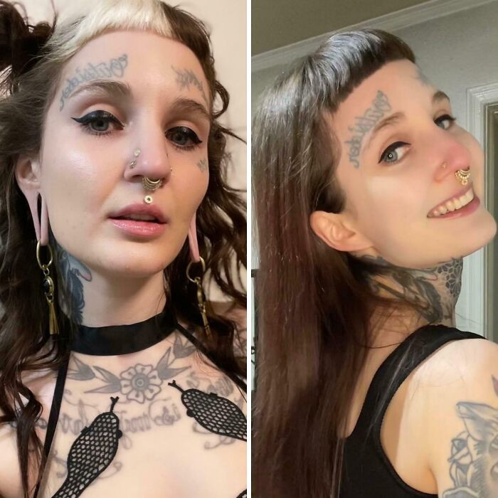 "My Ears Before And After Getting Them Reconstructed (Almost 3 Years Healed)"