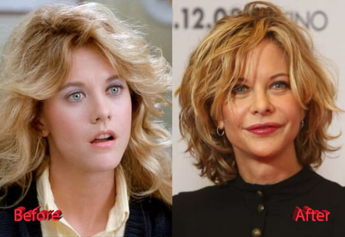 3. Meg Ryan