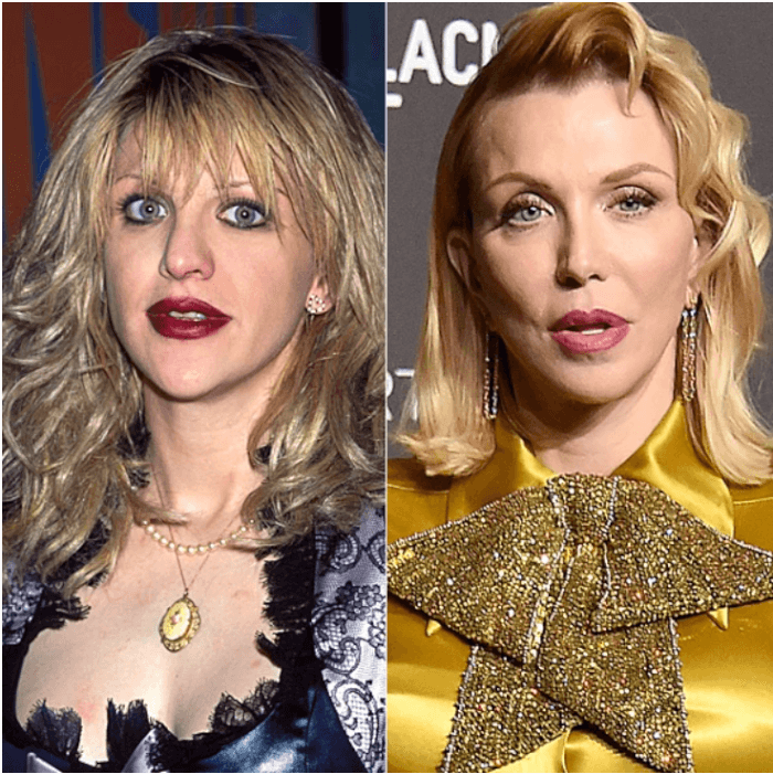 1. Courtney Love told Jimmy Kimmel in 2014 about the surgery she had when she was 20.