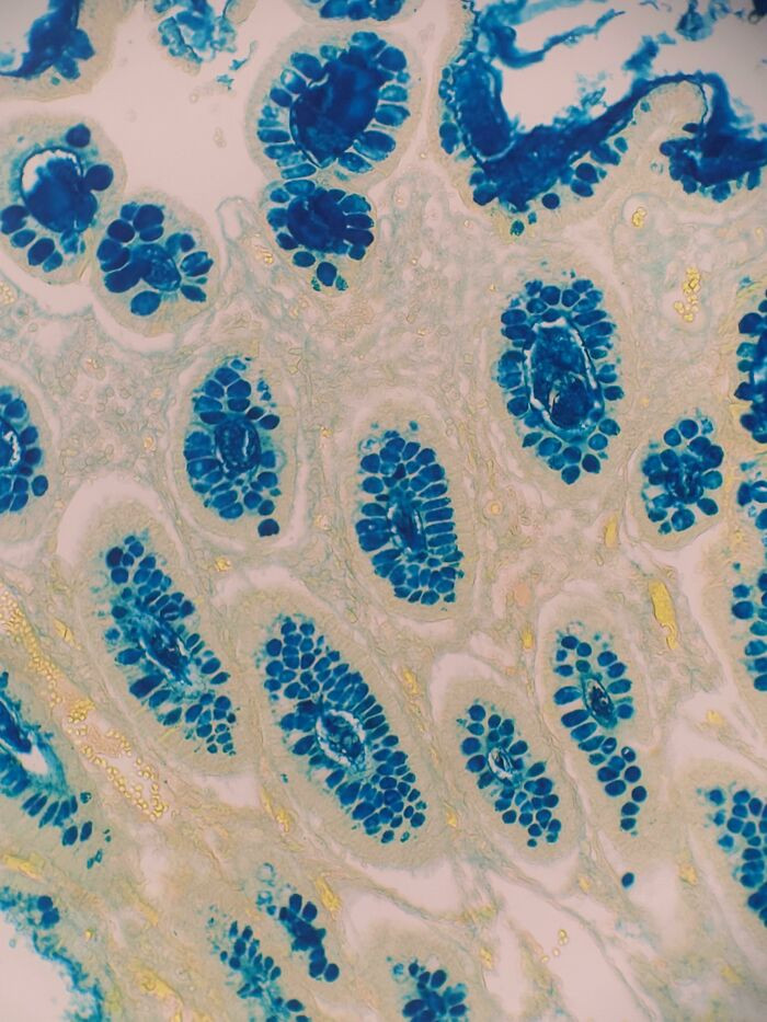 "The Colloidal Iron Tissue Stain Utilizes Prussian Blue Chemical Reaction To Stain Acidic Mucin Secretions With Prussian Blue Color For Viewing Under A Microscope"
