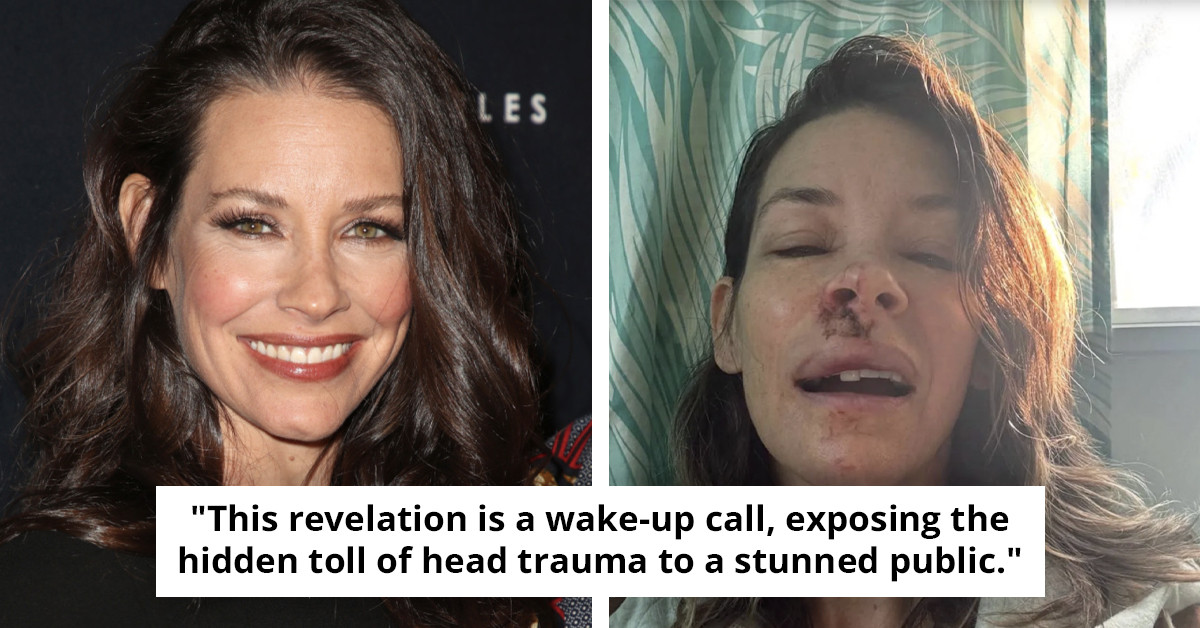 Evangeline Lilly discloses impact of brain injury following traumatic incident in May