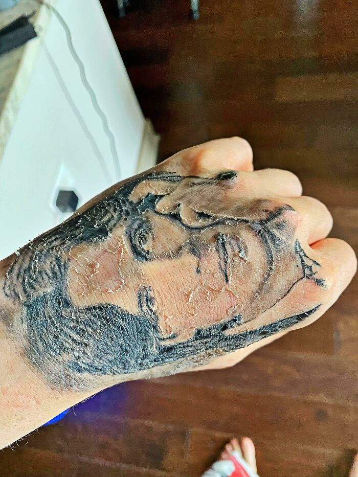 6. My Oscar Wilde Tattoo Is Peeling And It Looks Like The Picture Of Dorian Gray