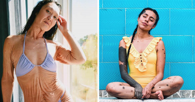 50 Beautiful Photos Of People Appreciating Their Unique Genes And Physical Appearances