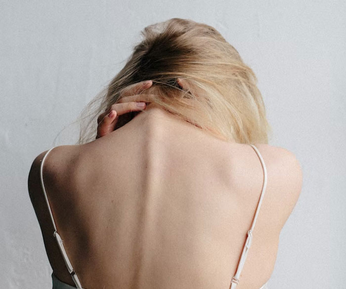 21. Psoriatic arthritis