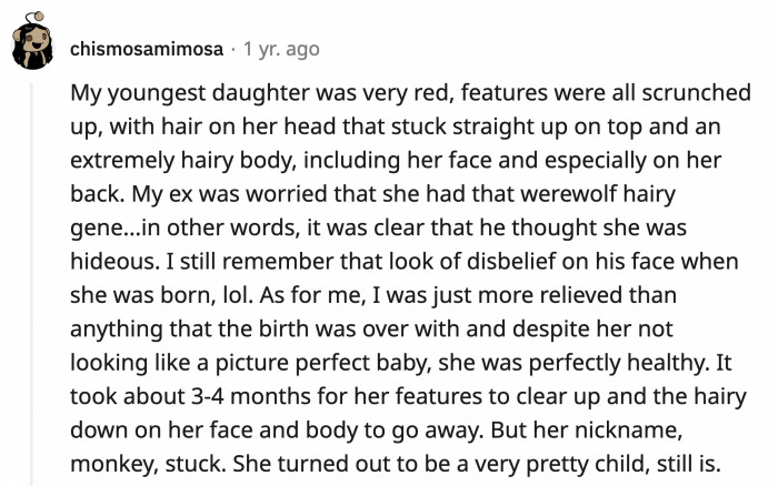 10. At least the hairy baby was healthy and grew up beautiful. She will hate that nickname soon enough.