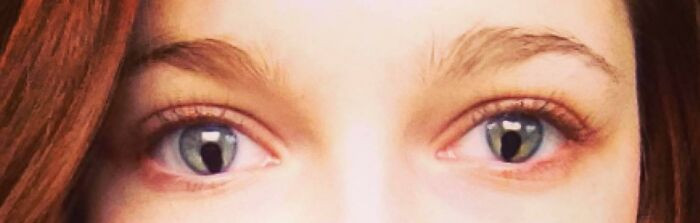 Keyhole-shaped pupils