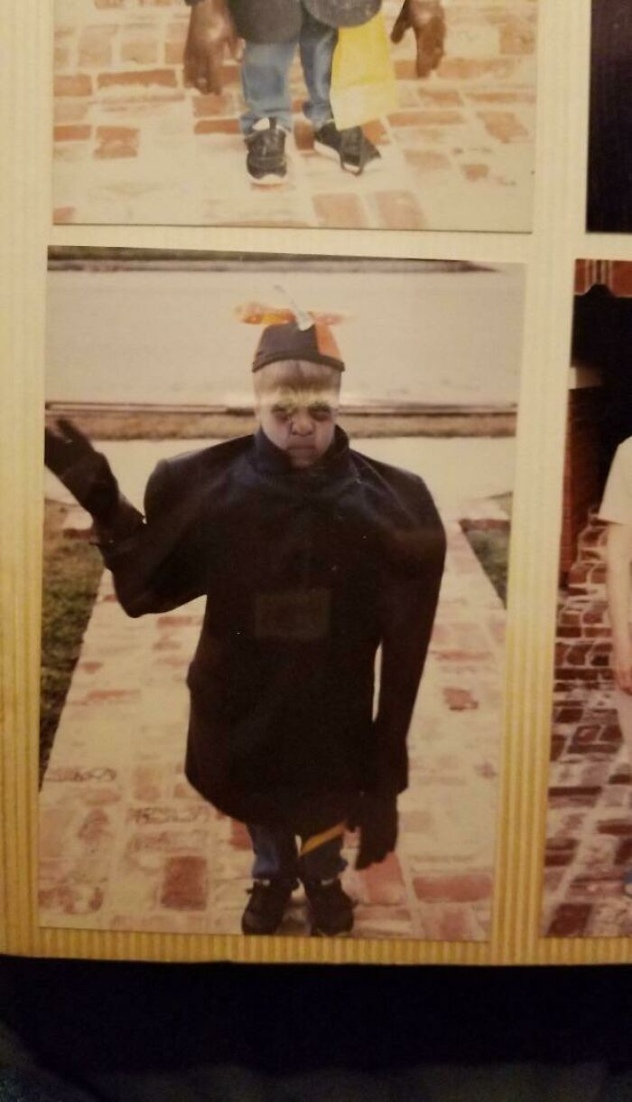 The other children kept their distance, and he broke down in tears every time he saw his reflection.