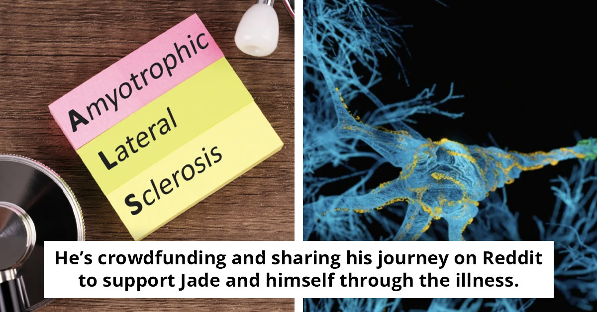 33-Year-Old Man Living with ALS Shares the First Subtle Sign He Experienced Before His Diagnosis