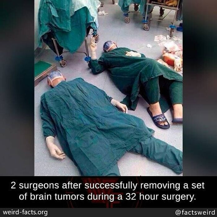 20. Two surgeons spent 32 consecutive hours successfully removing tumors from a brain