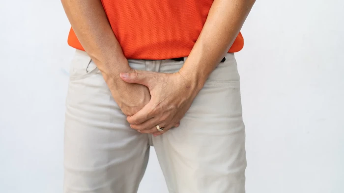 Varicocele affecting sperm motility, with varicocelectomy surgical treatment for fertility