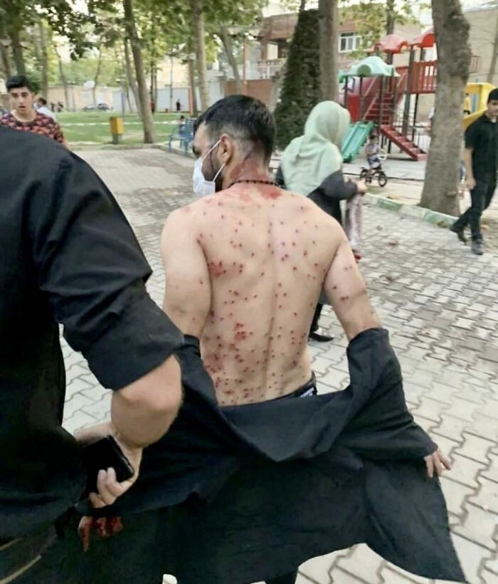 43. Man Shielded Many Women And Took All Pellets Shotgun On Himself During Anti-Hijab Protest In Tehran