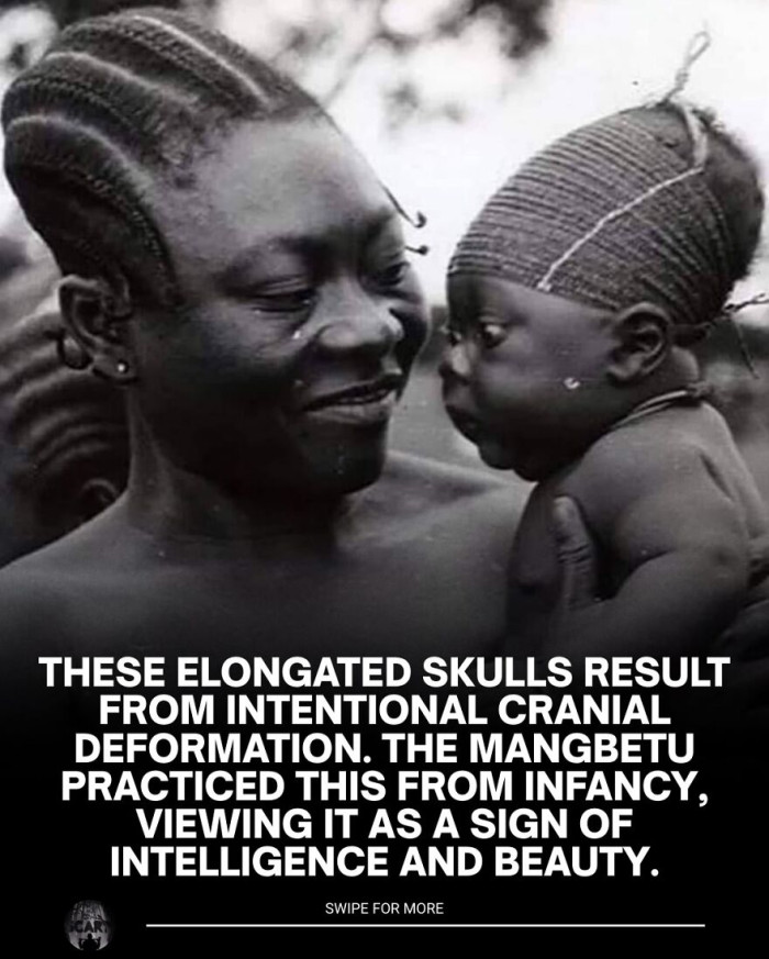 6. The elongated skulls