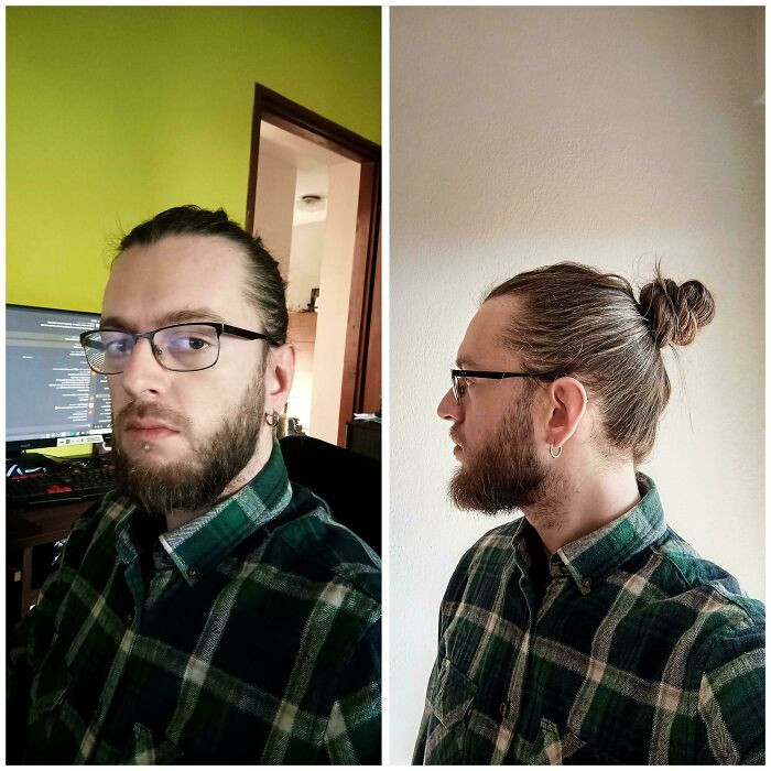 "Update - Got Rejected From A Dream Job Because I Have A Non-Conventional Male Look"