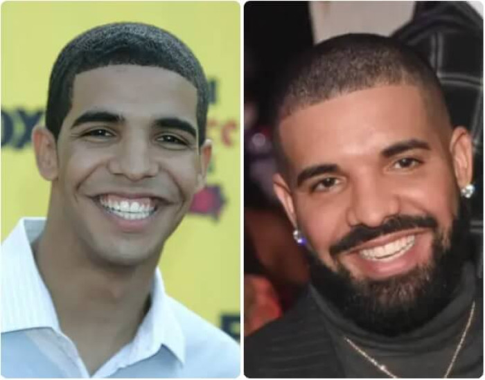 1. Drake