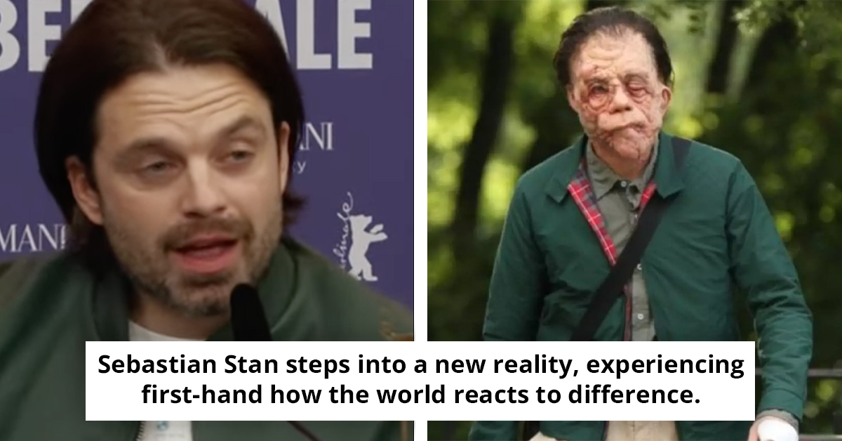 Sebastian Stan Learns Brutal Truth About Human Nature After Stepping Out In Disfiguring Facial Prosthetics