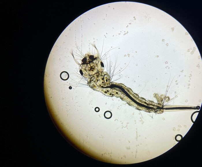 "Here Is A Close-Up Of A Mosquito Larva Under A Microscope. Looks Vicious"