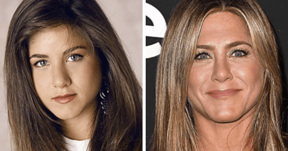 22 Times Celebrities Got Their Noses Done And It Automatically Made Them More Attractive