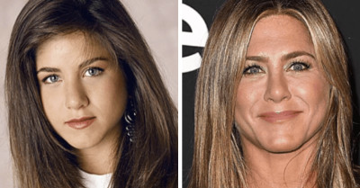 22 Times Celebrities Got Their Noses Done And It Automatically Made Them More Attractive