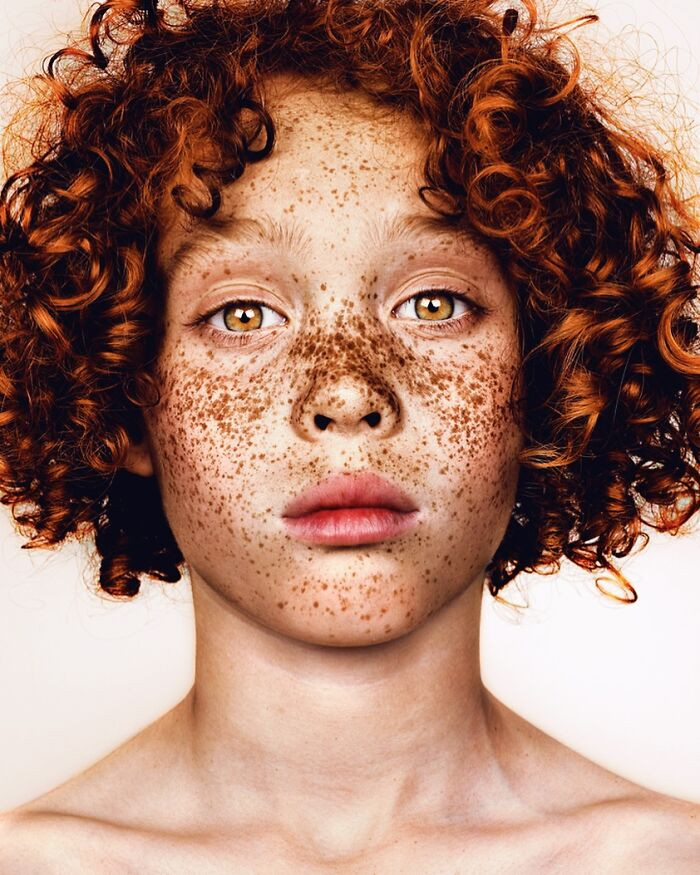 “Josh” - Freckles