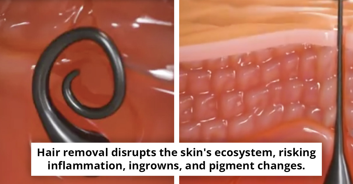 Stunning simulation reveals the true effects of pulling a hair from your skin.