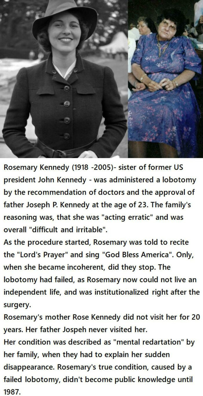 8. Rosemary Kennedy And Lobotomy
