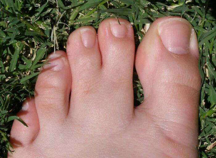 Webbed middle toes