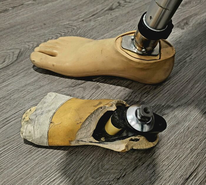 "My New Prosthetic Foot Shell Versus The One I Walked On For Two Years"