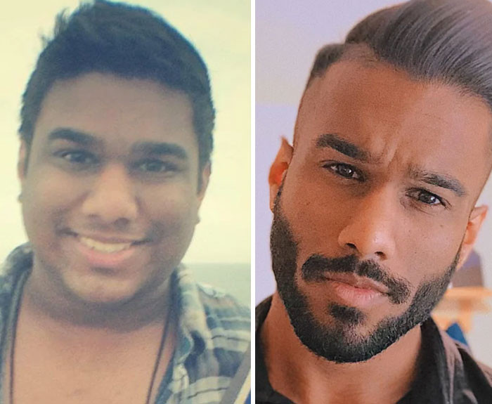 "M/28/6' [285 > 180 = 105lbs Lost] (6 Years). Face Progress: I Ran Into An Old College Friend Today Who Literally Refused To Believe It Was Me Because I Am "Unrecognizable"