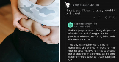 Woman Accused By Boyfriend Of "Cheating On Weight Loss" For Losing 22 Pounds After Putting A Balloon In Her Stomach