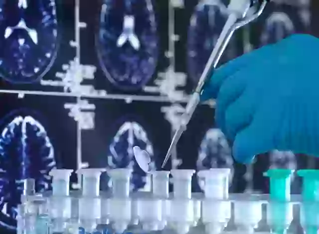 Memory lapses are often one of the earliest signs of Alzheimer’s.