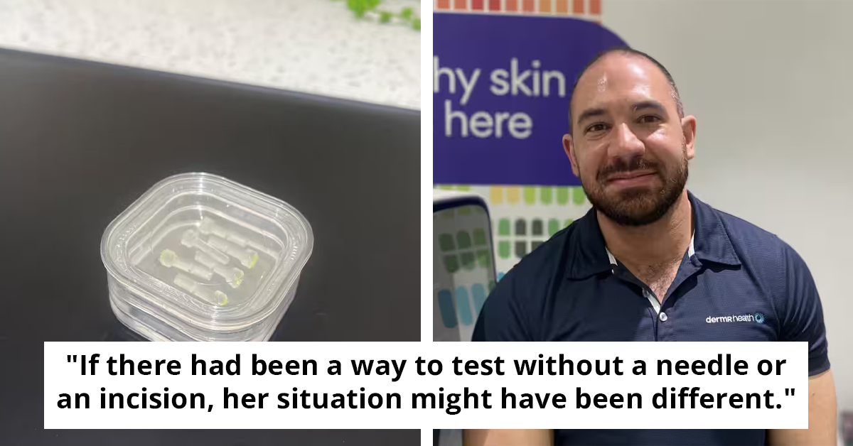 This Quick, Painless Skin Cancer Screening Could Save Thousands of Lives