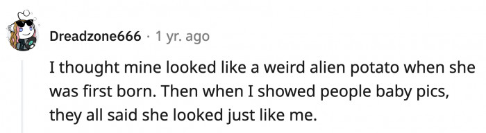 9. Oh girl, giving birth must hurt less than this.