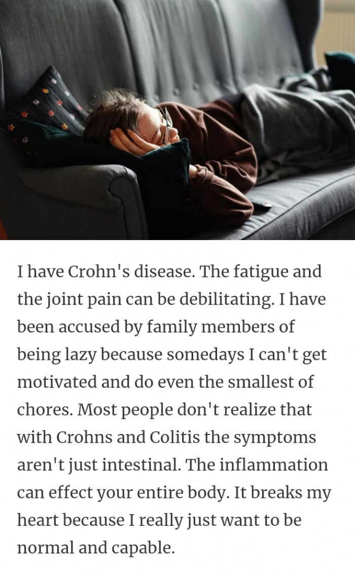 2. Crohn's disease