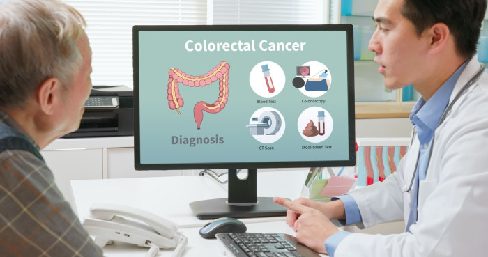 Health article graphic highlighting colorectal cancer symptoms and early detection.