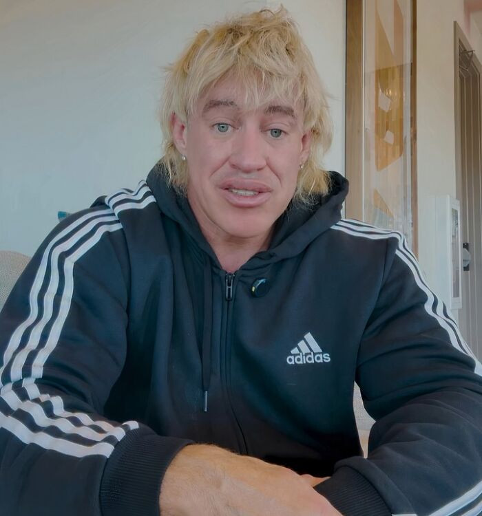 "Fitness Influencer Admits To Fabricating War Injury"