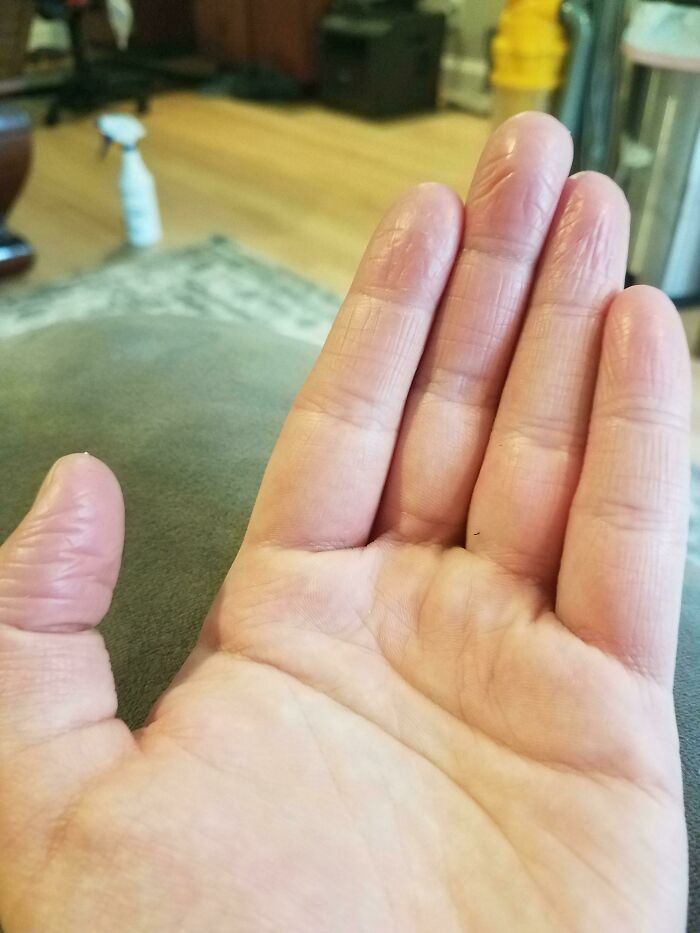 "I Don't Have Fingerprints"