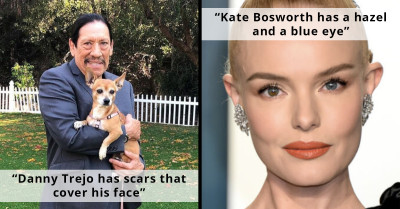 8 Celebrities Who Have Acknowledged and Accepted Their Individual Beauty Features