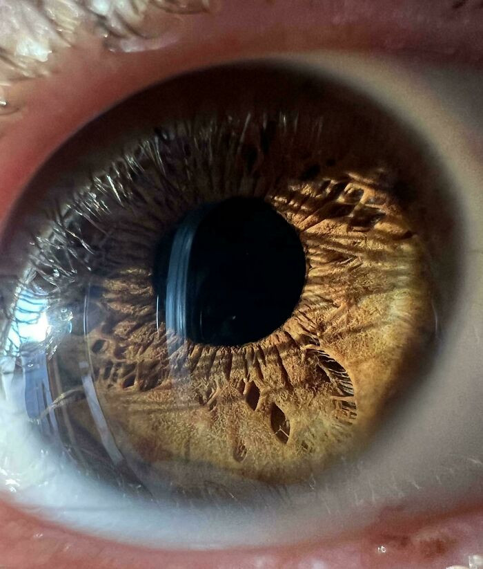 "I Have The Shape And Texture Of A Feather At The Bottom Of My Iris"