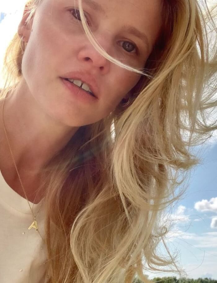 10. Lara Stone's discolored teeth not only propelled her to modeling fame but also changed how people perceive 'pearly whites.'