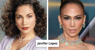 See How 14 Celebrities Changed After Their Cheekbone Makeovers