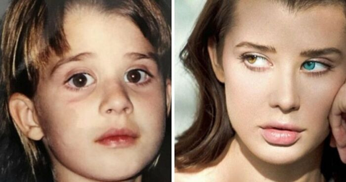 "Instagram "Influencer" Called Out By Her Own Dad For Claiming To Have Heterochromia"