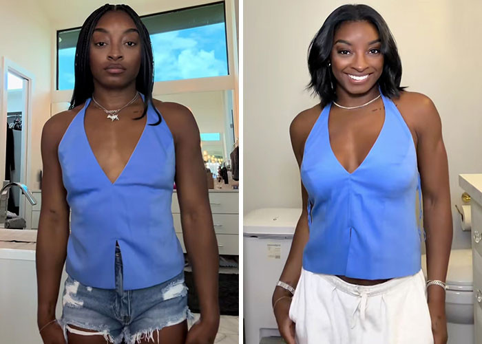 Simone Biles - Breast augmentation