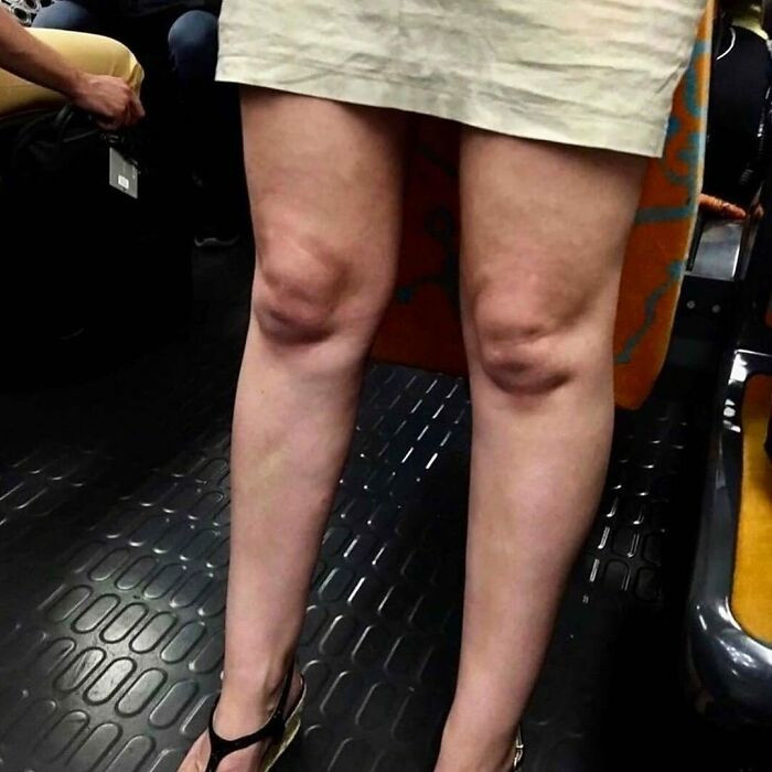 41. Those are faces, right?