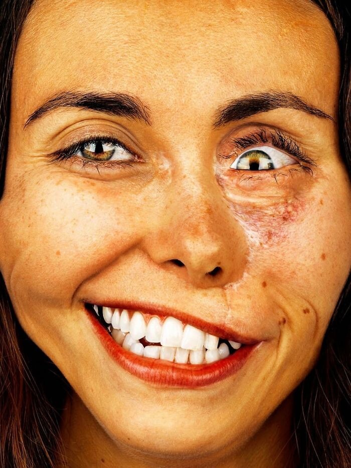 “Isabella Welch” - Scars