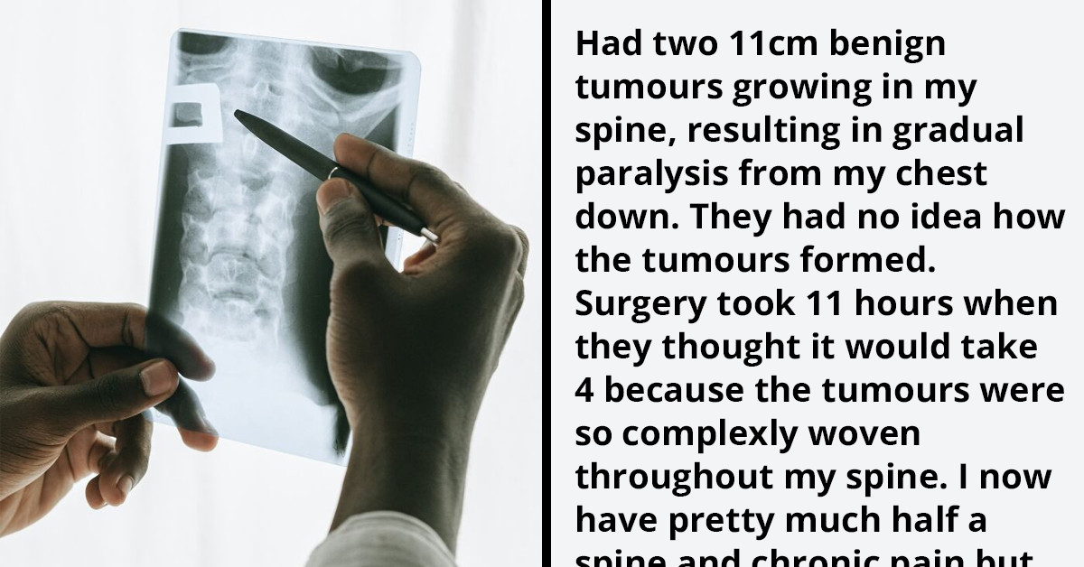 People With One-In-A-Million Experiences Share Their Interesting Stories