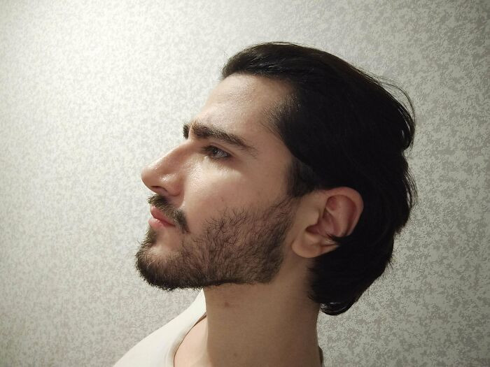 "6 Months In And I Look Like Lord Farquaad"