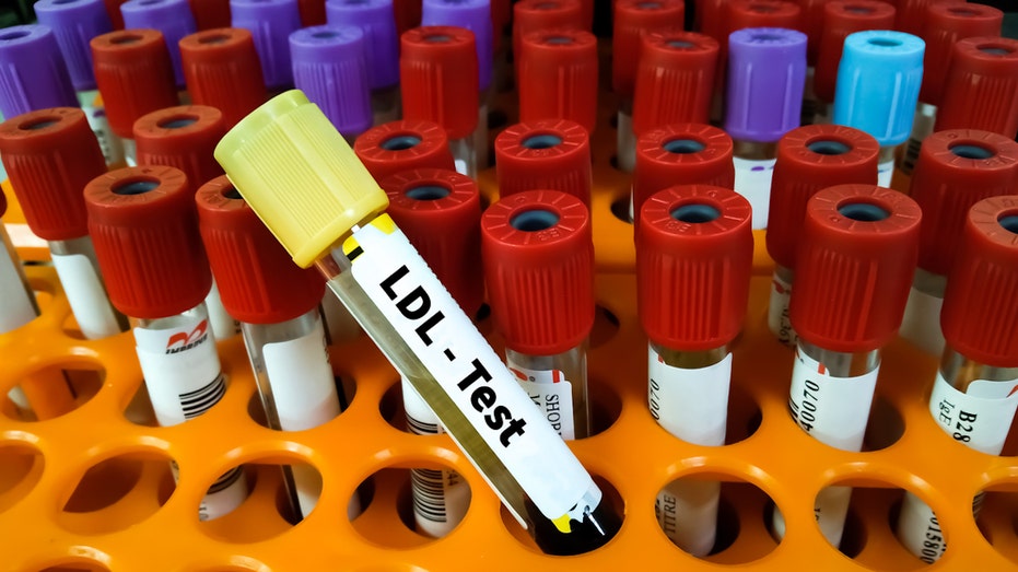 Nick explained there is a scientific link between lower BMI and higher LDL cholesterol.