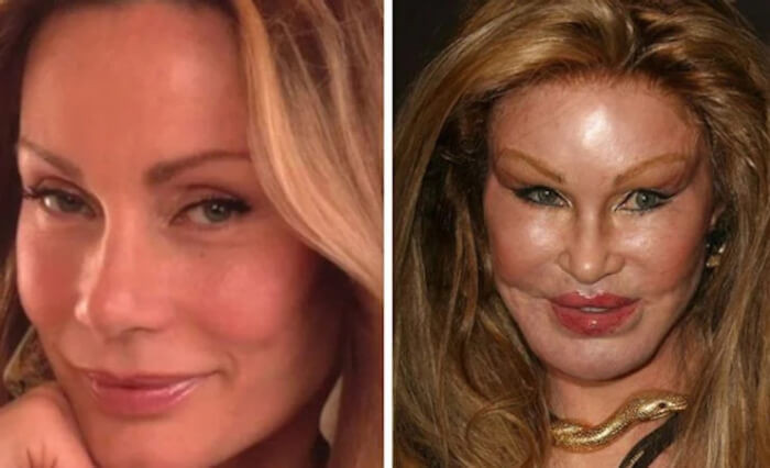 7. Jocelyn Wildenstein